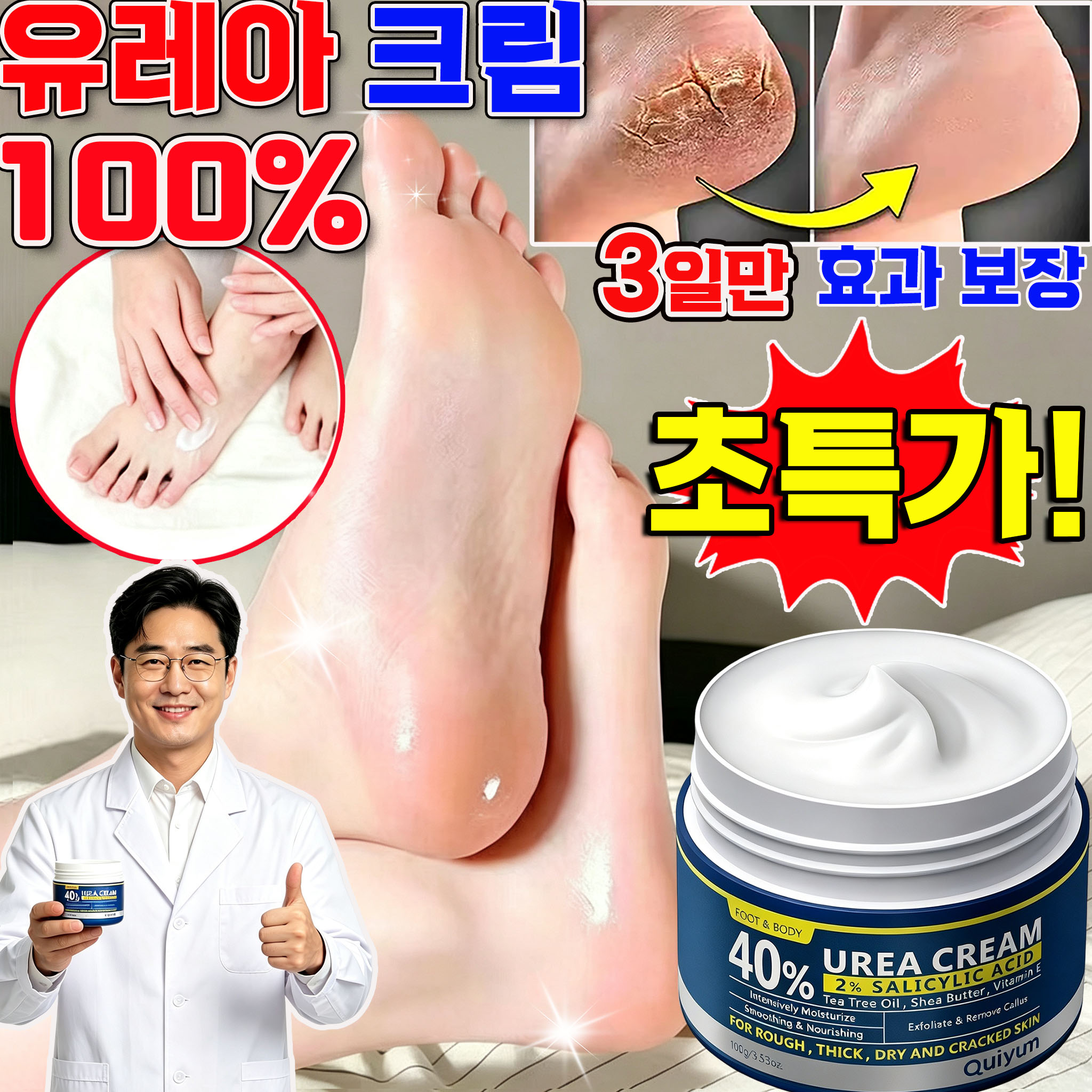 발각질 고민 끝! 유레아 크림 1위 풋크림 리뷰